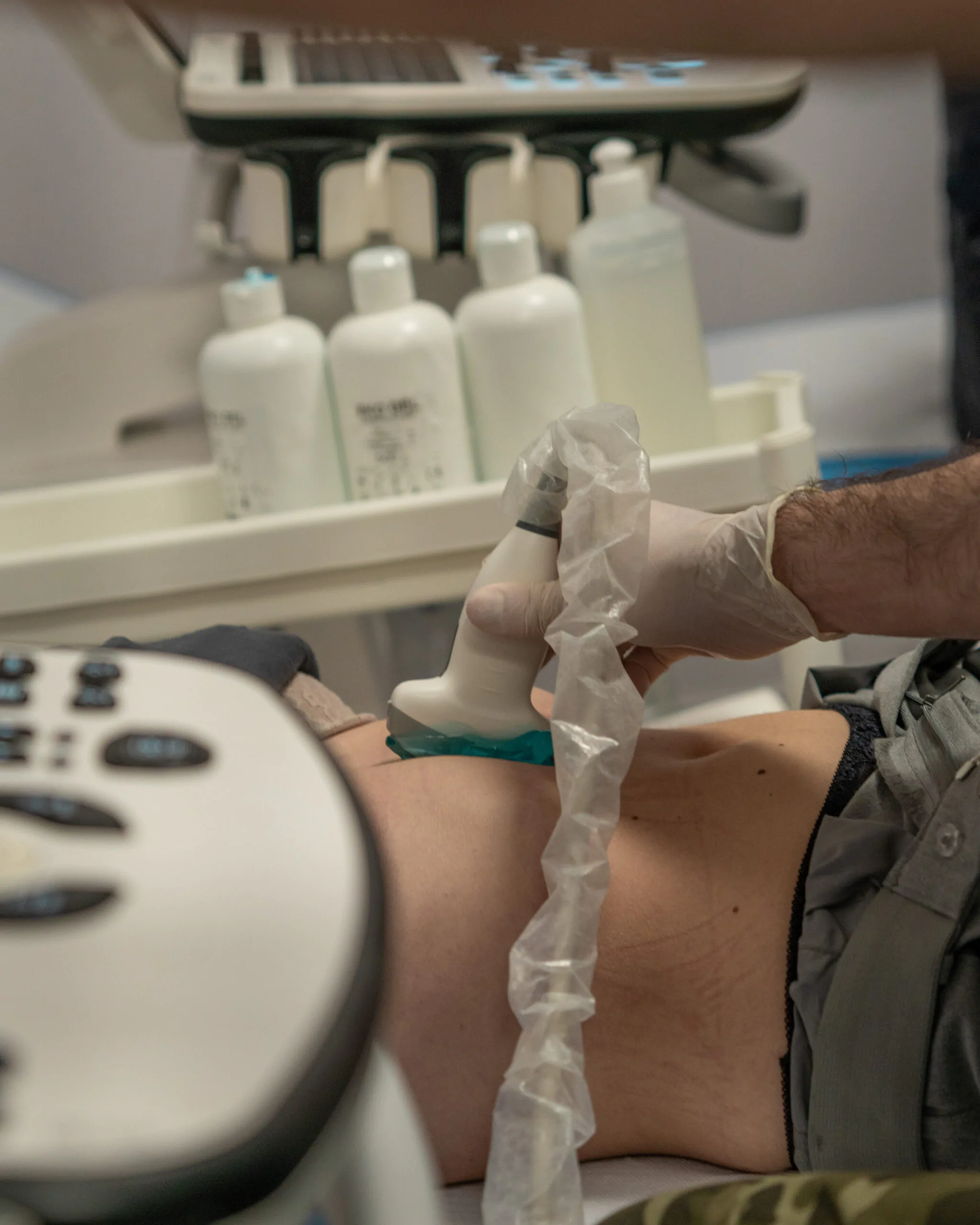 USG w gabinecie lekarza POZ  – diagnostyka jamy brzusznej i płuc