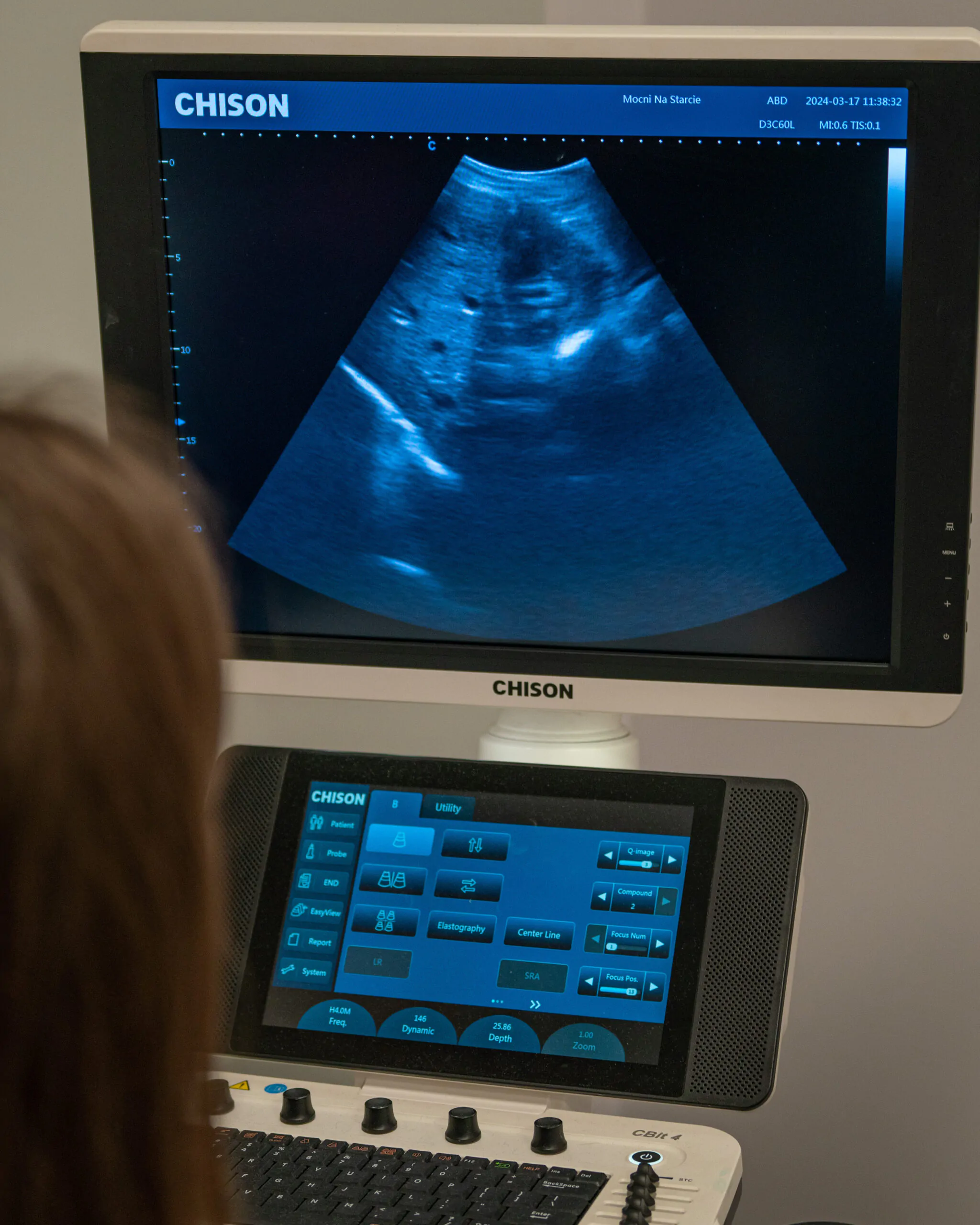 ABC lekarza stażysty z głowicą