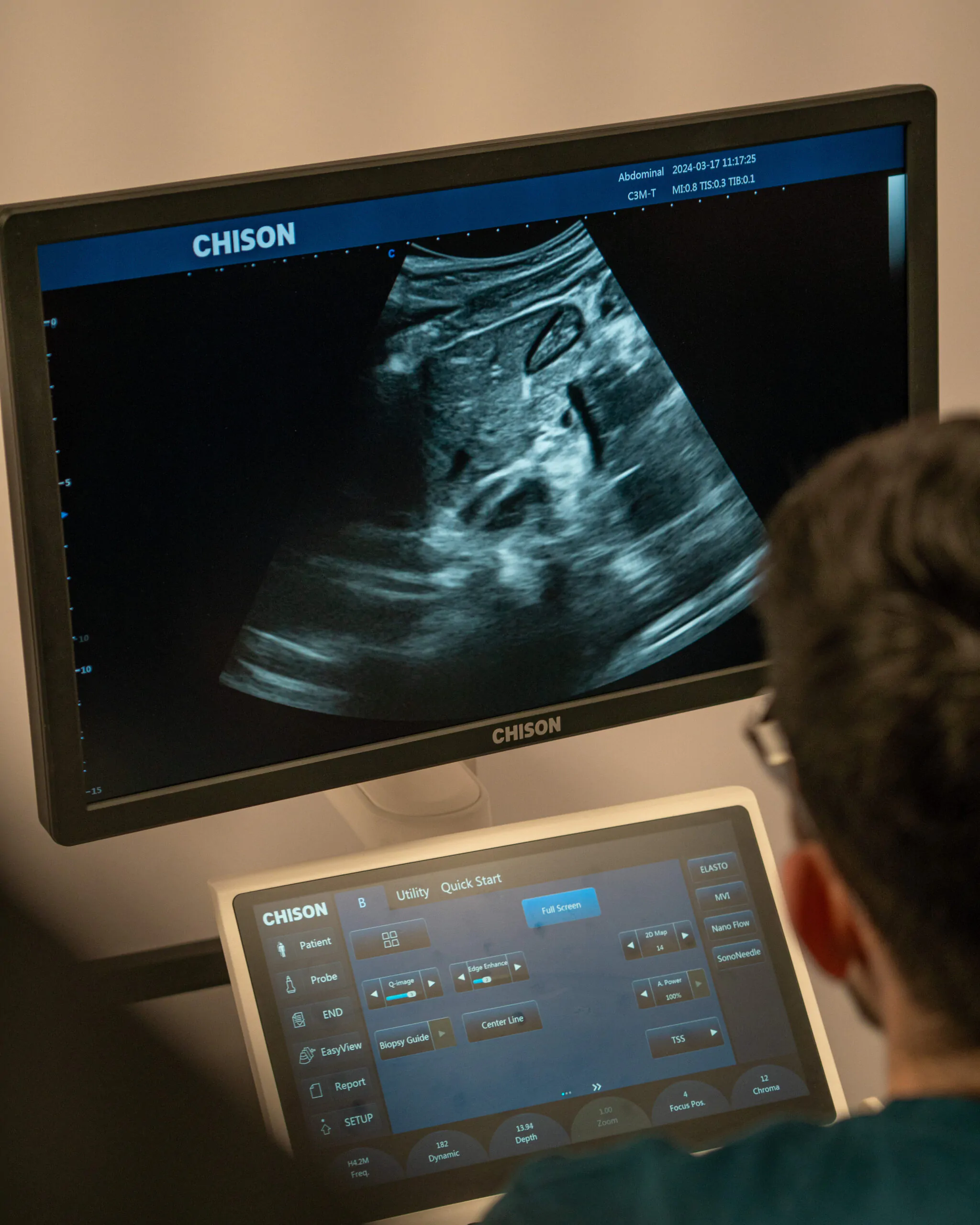 USG w gabinecie lekarza POZ – diagnostyka jamy brzusznej i płuc